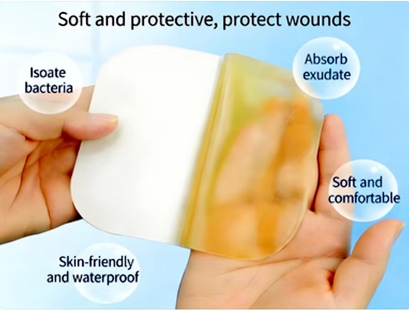 Dressing Hydrocolloid: Pilihan Inovatif kanggo Perawatan Wound