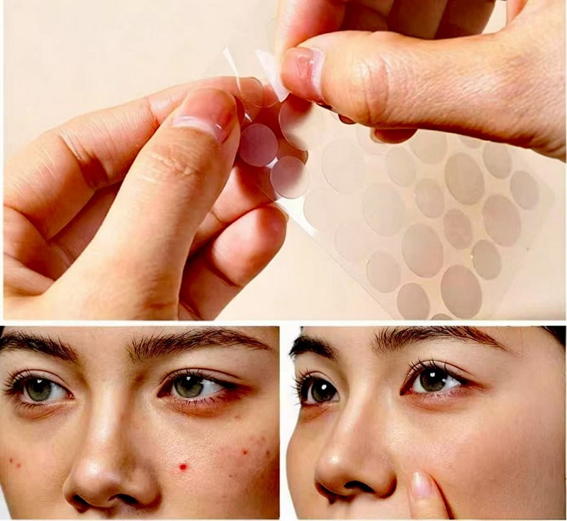 Kepiye Cara Gunakake CmallBio Pimple Patches Sewengi kanggo Hasil Maksimal?